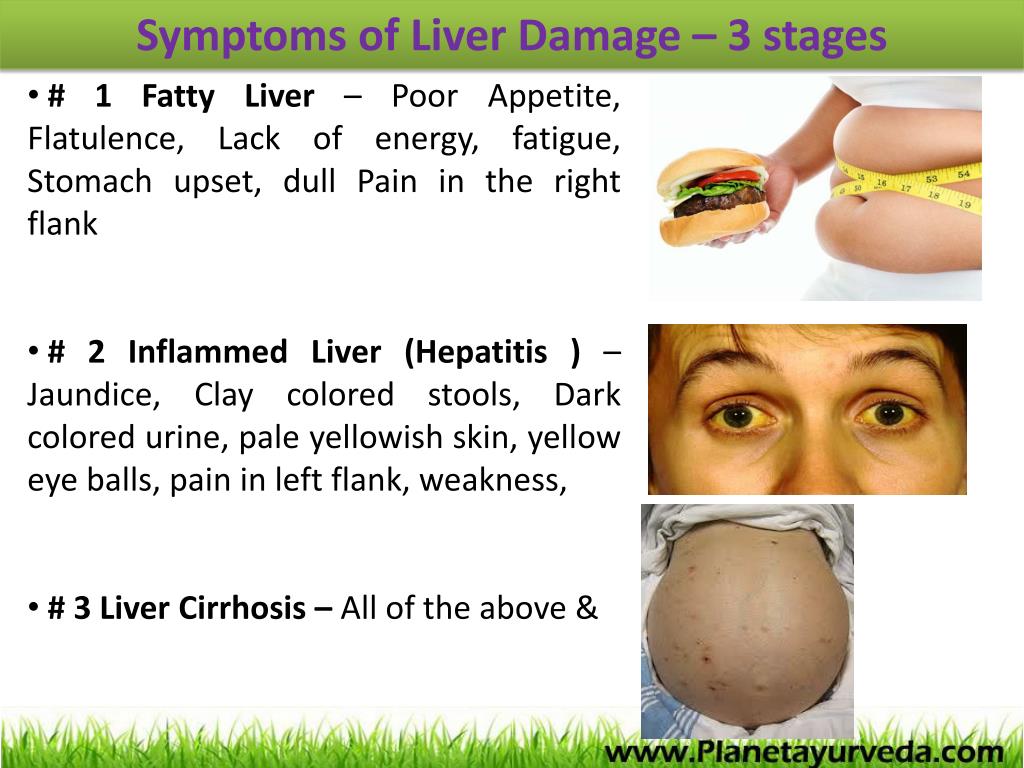 PPT LIVER CIRRHOSIS AYURVEDIC TREATMENT PowerPoint Presentation