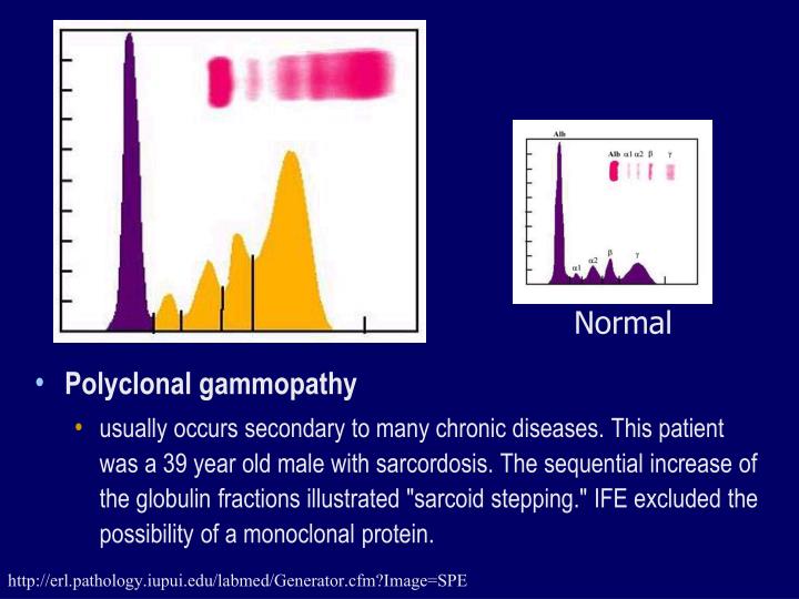 PPT Electrophoresis and its Application for diagnosis PowerPoint