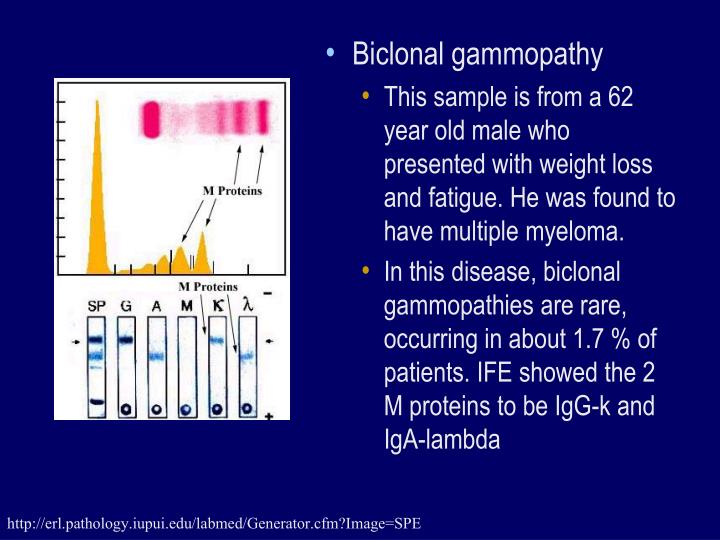 PPT Electrophoresis and its Application for diagnosis PowerPoint
