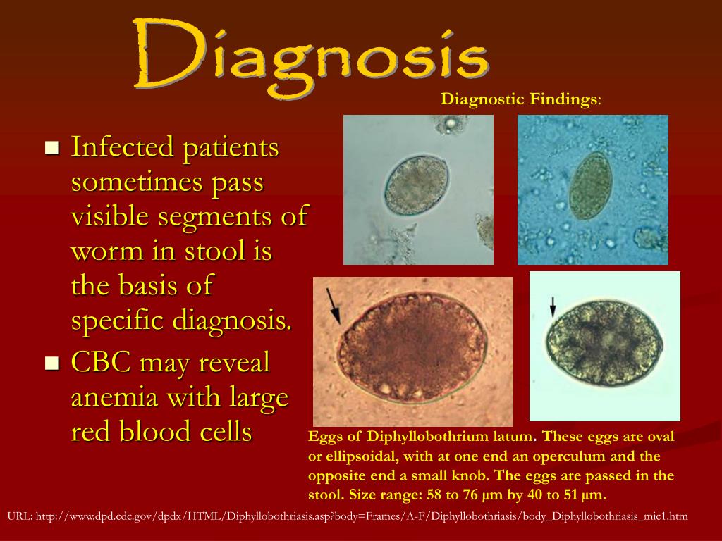 PPT Broad Fish Tapeworm PowerPoint Presentation, free download ID115050