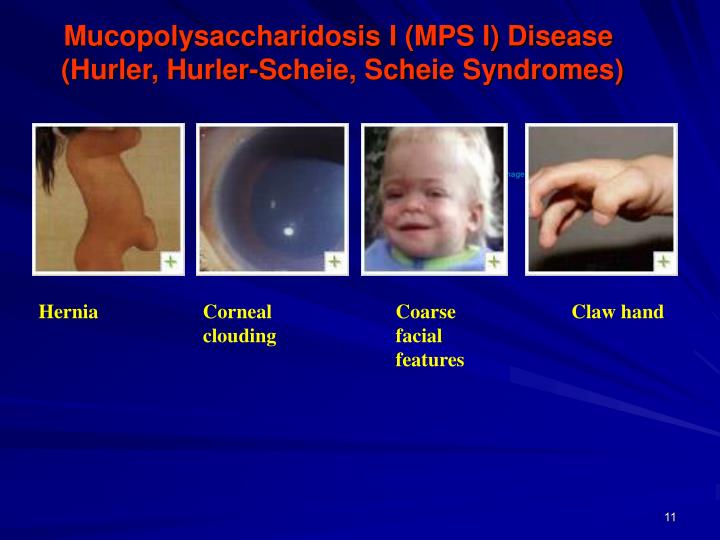PPT Mucopolysaccharides PowerPoint Presentation ID1158702