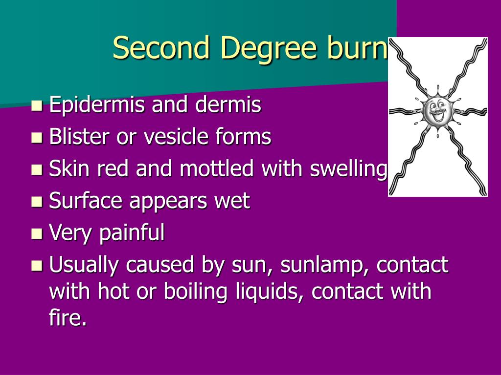 PPT First Aid PowerPoint Presentation, free download ID1163744