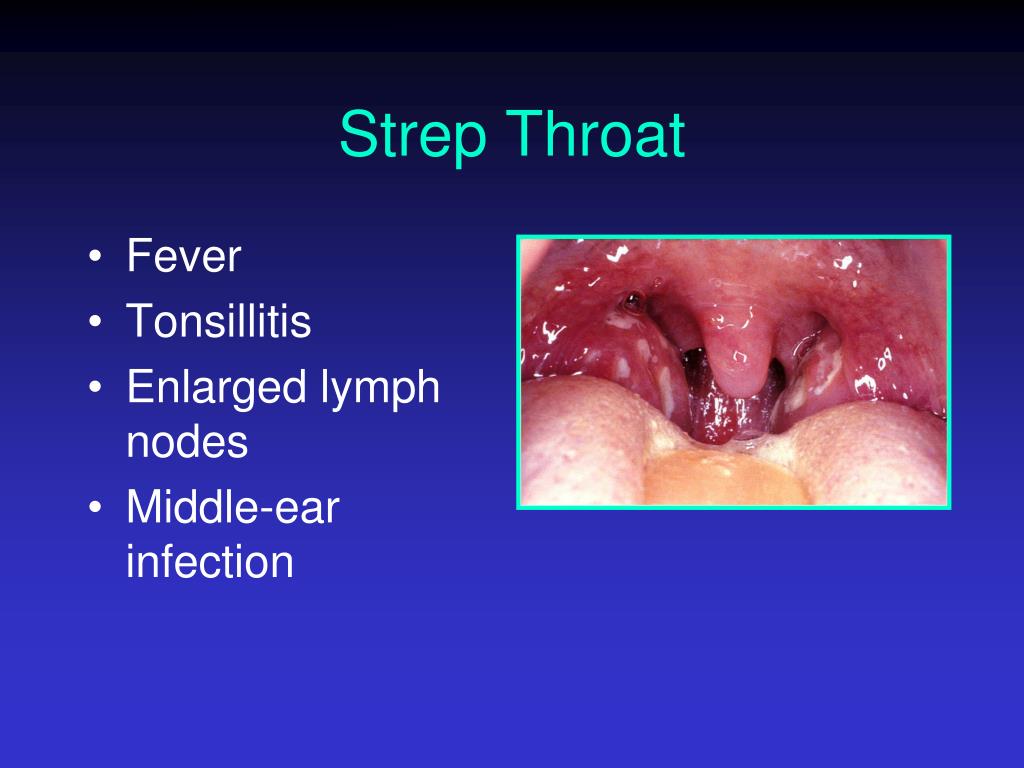 PPT Diseases of the Respiratory System PowerPoint