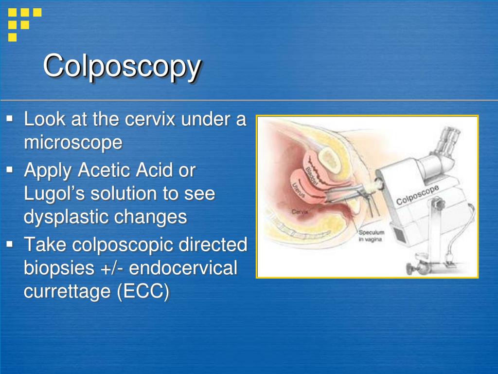 PPT Management of Abnormal Pap Smears and Cervical Dysplasia