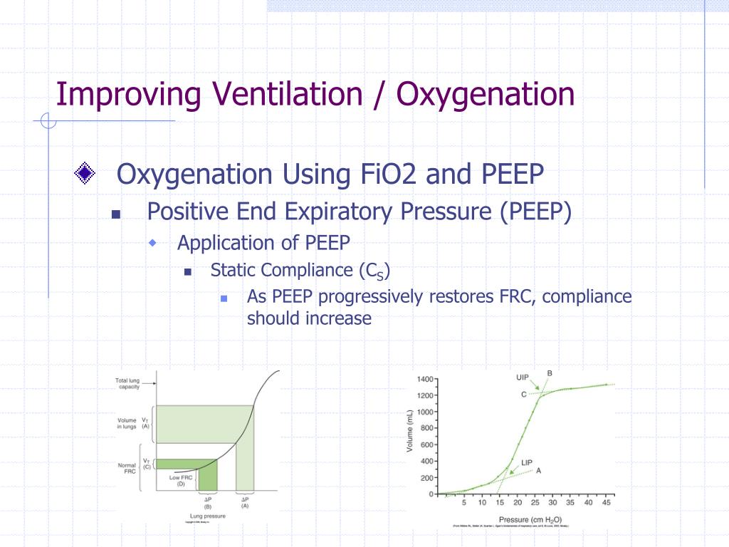 PPT Principles of Mechanical Ventilation PowerPoint Presentation