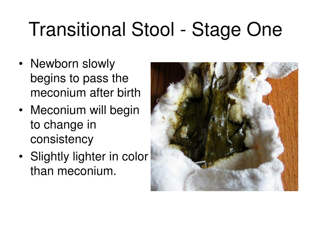 PPT Meconium A Sticky Situation PowerPoint Presentation, free