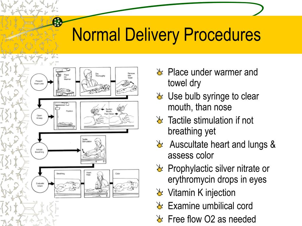 PPT Neonatal Resuscitation PowerPoint Presentation, free download ID1208437