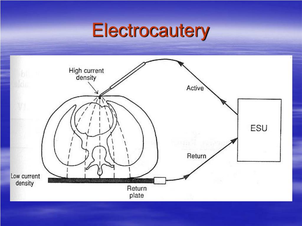PPT Electrical Safety PowerPoint Presentation, free download ID1209693
