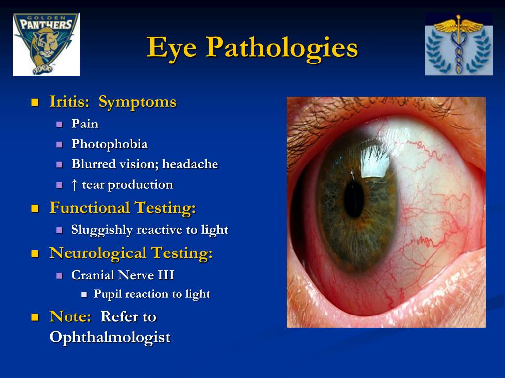 PPT Evaluation of Eye Pathologies PowerPoint Presentation, free download ID1215192