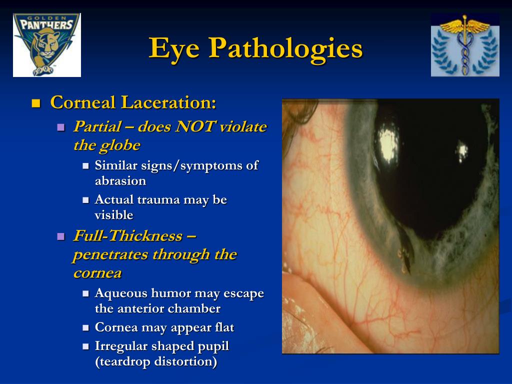 PPT Evaluation of Eye Pathologies PowerPoint Presentation, free download ID1215192