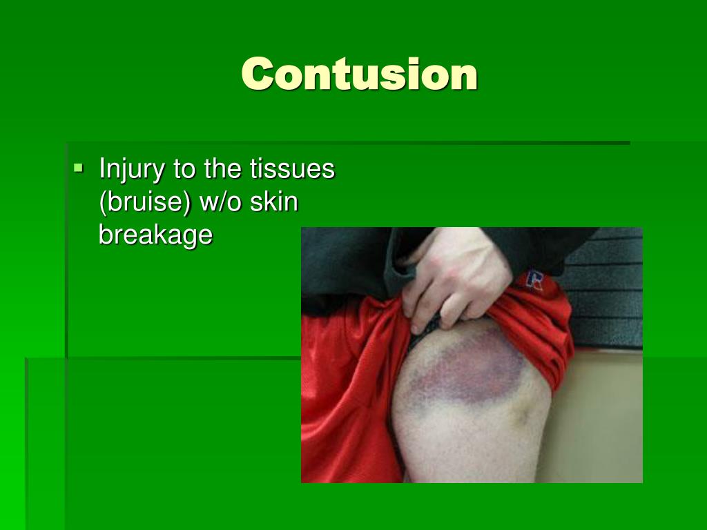 PPT First Aid Medical and Injury Terminology PowerPoint Presentation