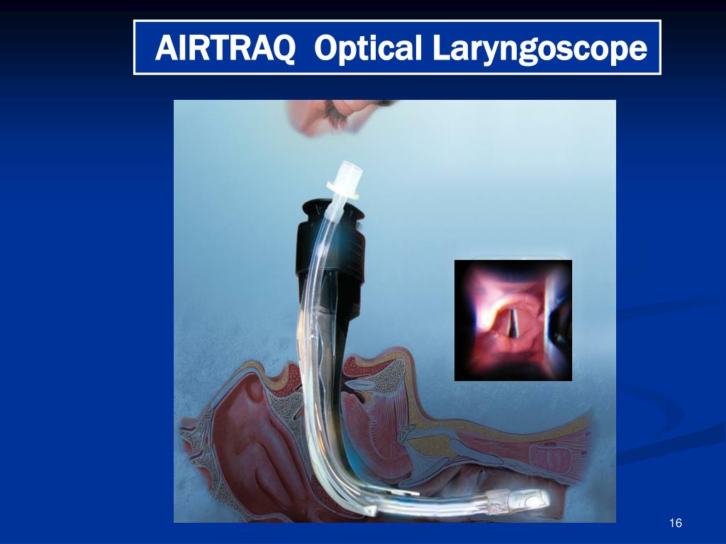 PPT AIRTRAQ LARYNGOSCOPE PowerPoint Presentation, free download ID
