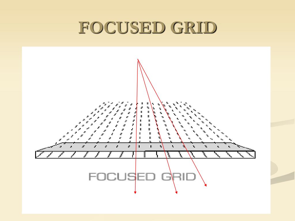 PPT RADIOGRAPHIC GRIDS PowerPoint Presentation, free download ID