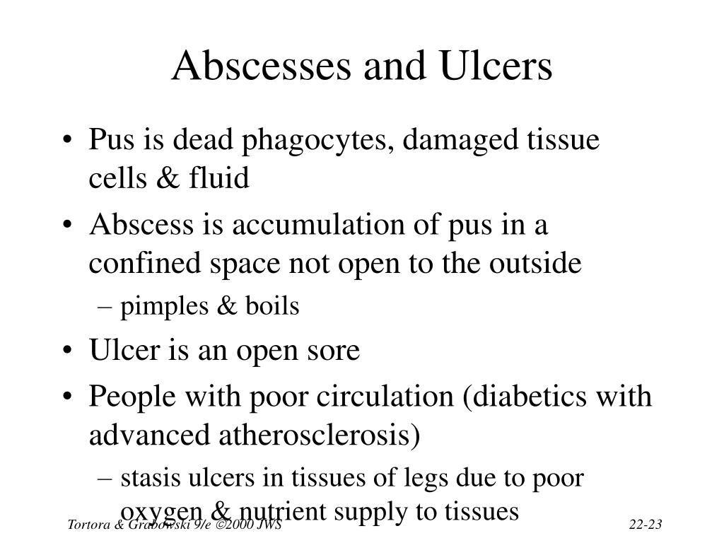 PPT Chapter 22 The Lymphatic System PowerPoint Presentation, free