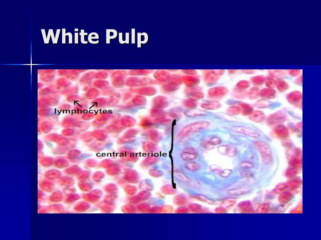 PPT Hyposplenism PowerPoint Presentation, free download ID1227809