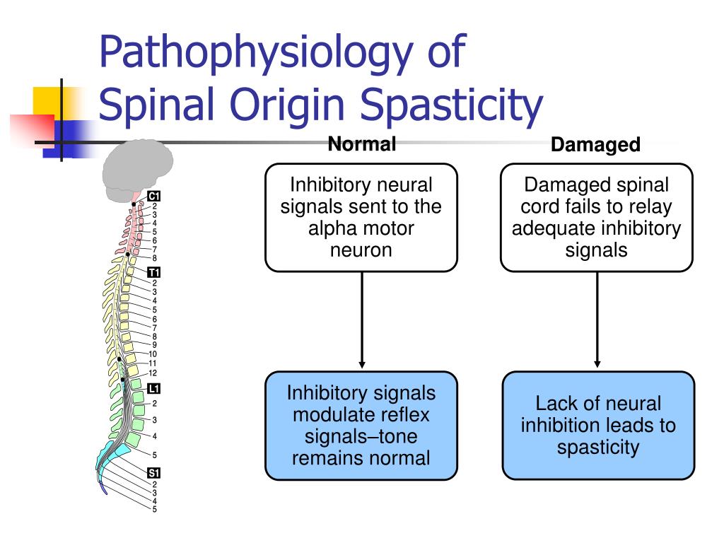 PPT Intrathecal Baclofen for Spasticity PowerPoint Presentation, free