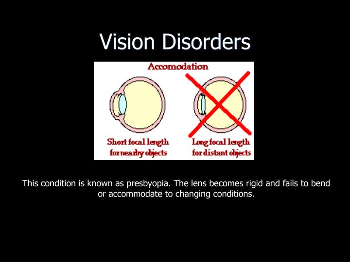 PPT Physics of the Eye and Intralase Surgery PowerPoint Presentation