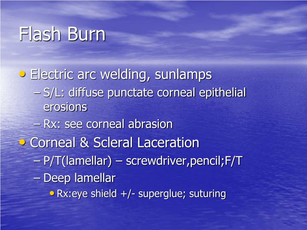 PPT UPDATE ON OCULAR TRAUMA PowerPoint Presentation, free download