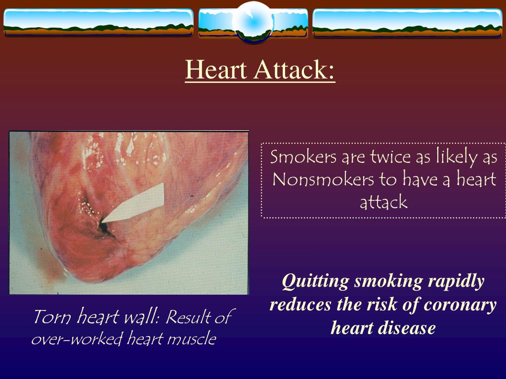 PPT Tobacco 101 Presentation PowerPoint Presentation, free download ID1271248