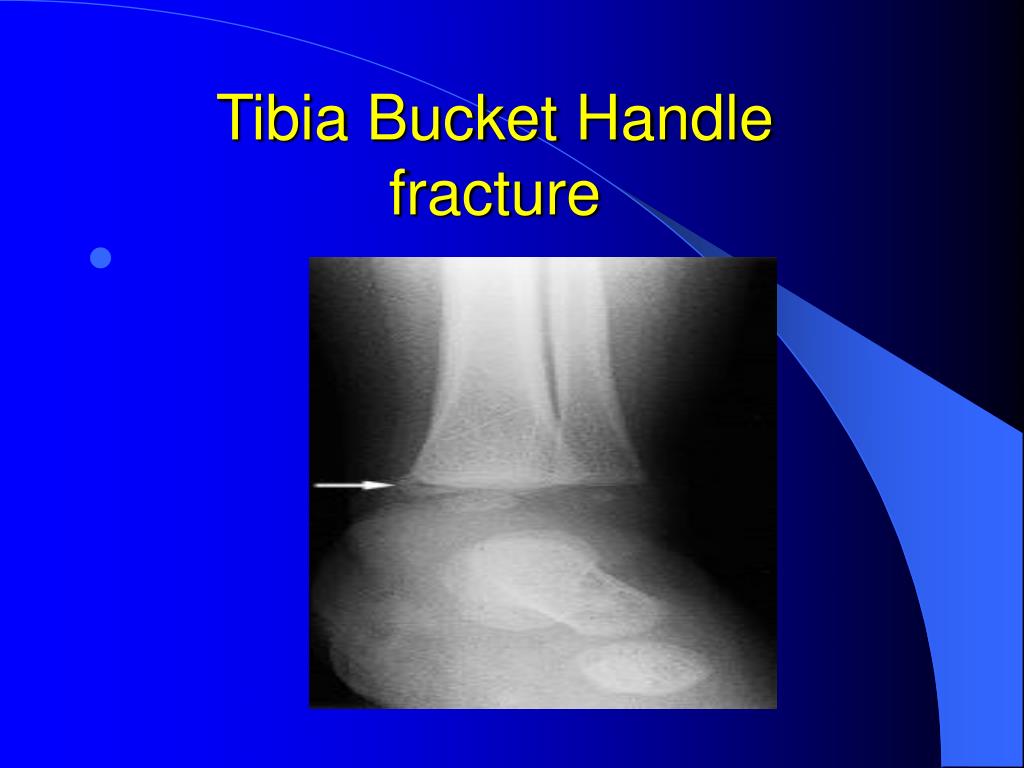 PPT Findings in Child Abuse PowerPoint Presentation, free download ID1274827