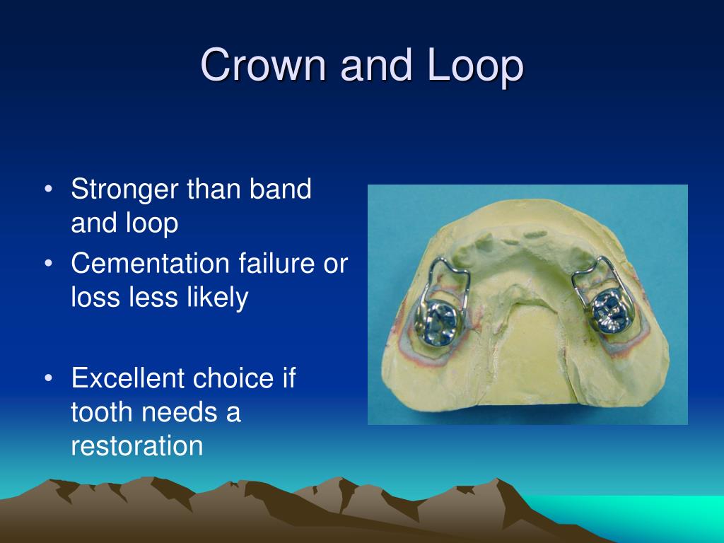 PPT Basic Space Maintainers Teaching Module and Competency PowerPoint