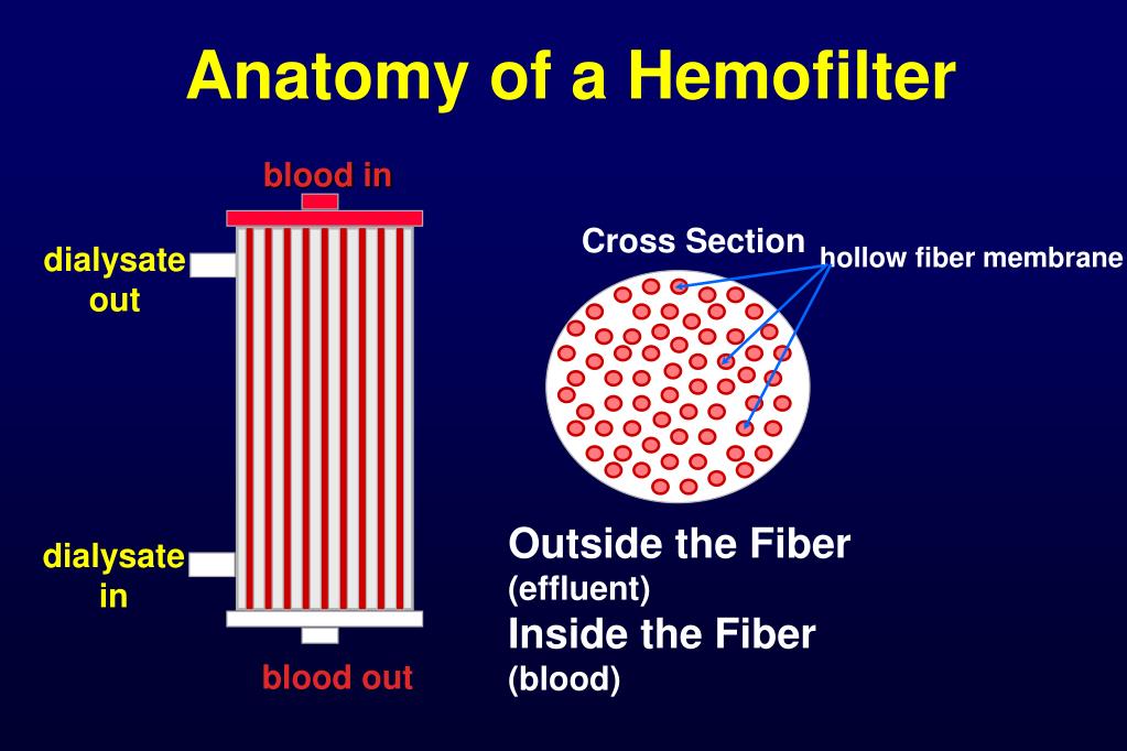 PPT Continuous Renal Replacement Therapy PowerPoint Presentation