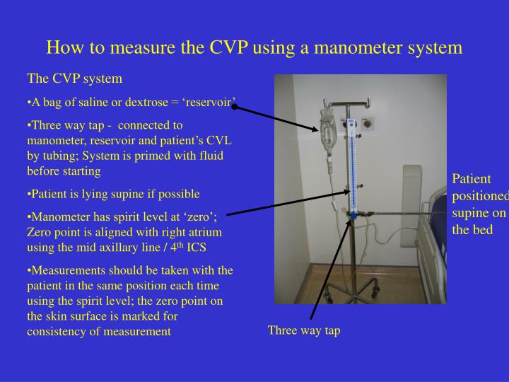 PPT Central Venous Pressure and Central lines PowerPoint Presentation ID1282598