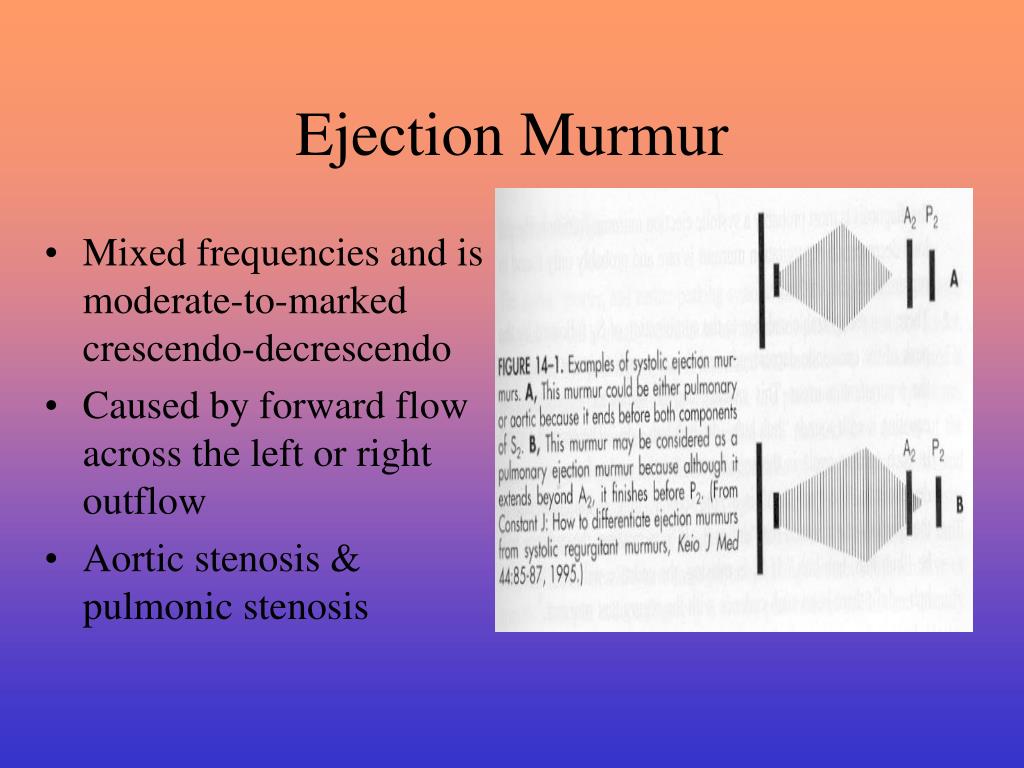 PPT Systolic Ejection Murmurs Chapter 14 PowerPoint Presentation