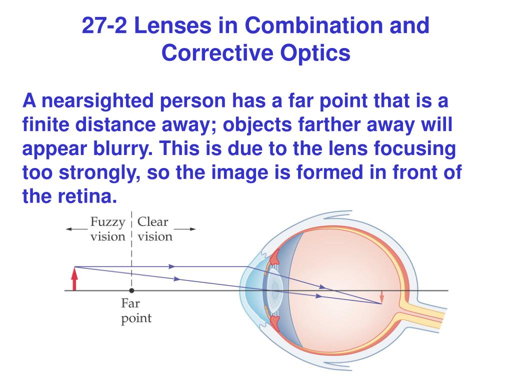 PPT Chapter 27 Optical Instruments PowerPoint Presentation, free