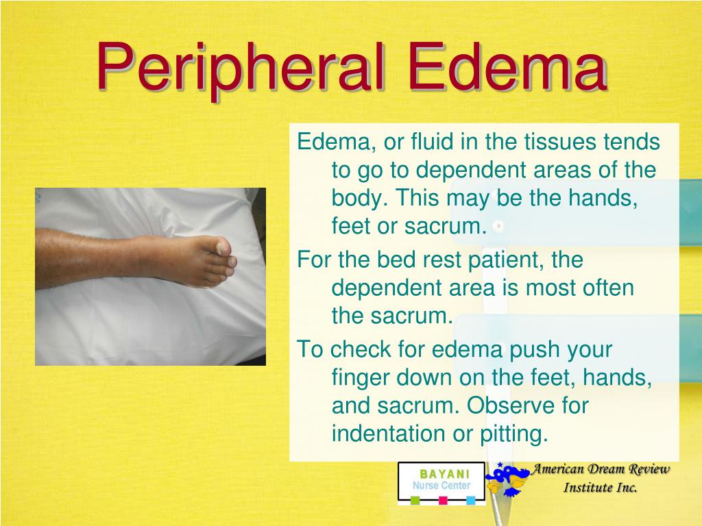 PPT 5 MINUTE ASSESSMENT PowerPoint Presentation, free