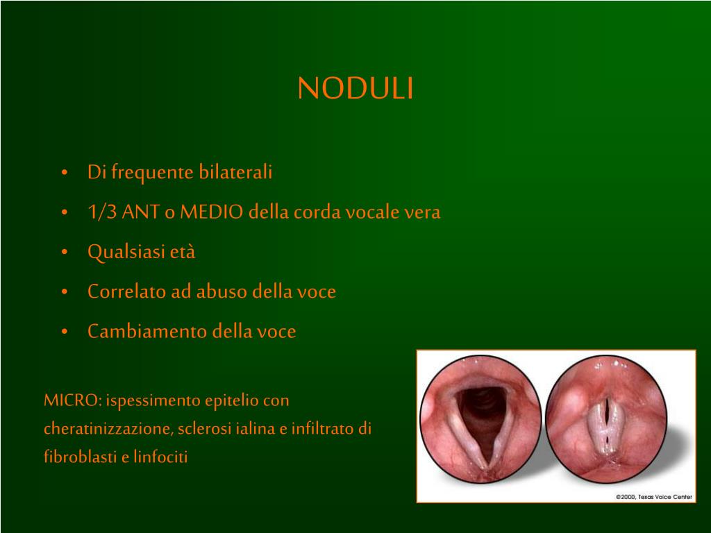 PPT LARINGE PowerPoint Presentation, free download ID1326144