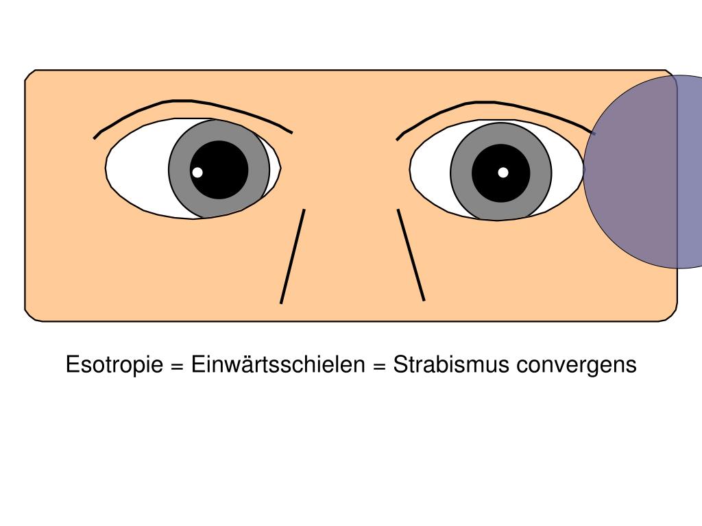 PPT Augenbewegungen und Schielen PowerPoint Presentation, free