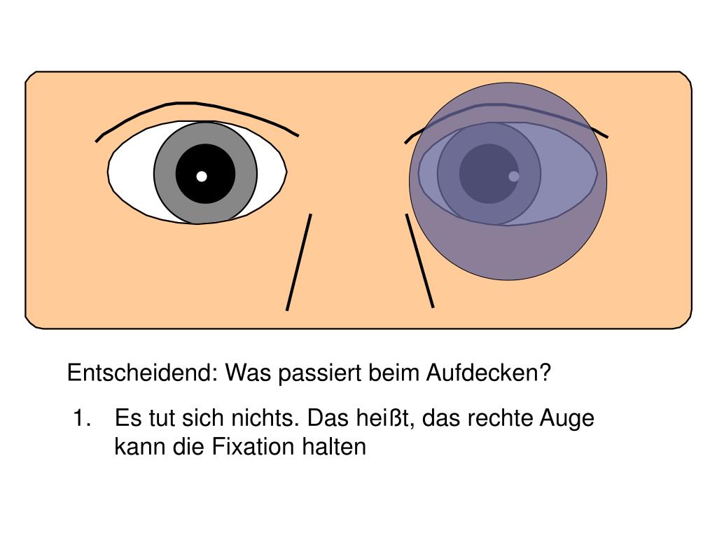 PPT Augenbewegungen und Schielen PowerPoint Presentation, free
