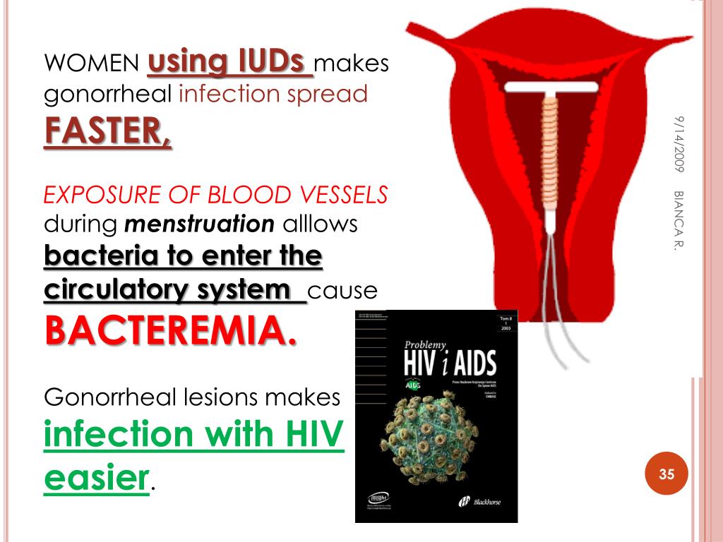 PPT GONORRHEA PowerPoint Presentation, free download ID1357652