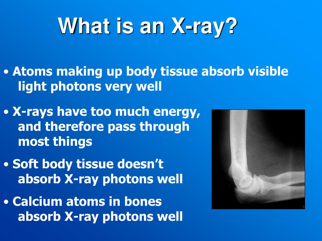 PPT How Do XRays Work PowerPoint Presentation, free download ID