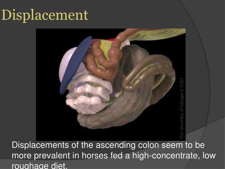 PPT Colic PowerPoint Presentation ID1384675