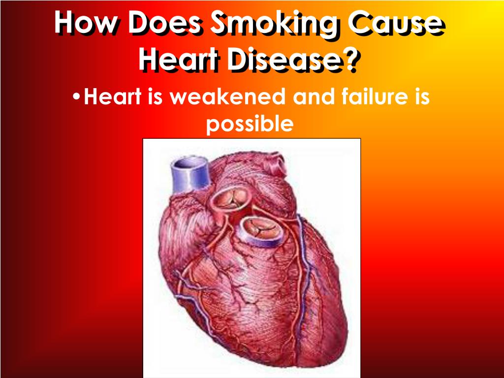 PPT Why is Smoking Bad for You? PowerPoint Presentation, free
