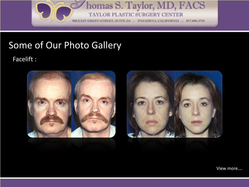 PPT Plastic Surgery in Los Angeles & Pasadena PowerPoint Presentation