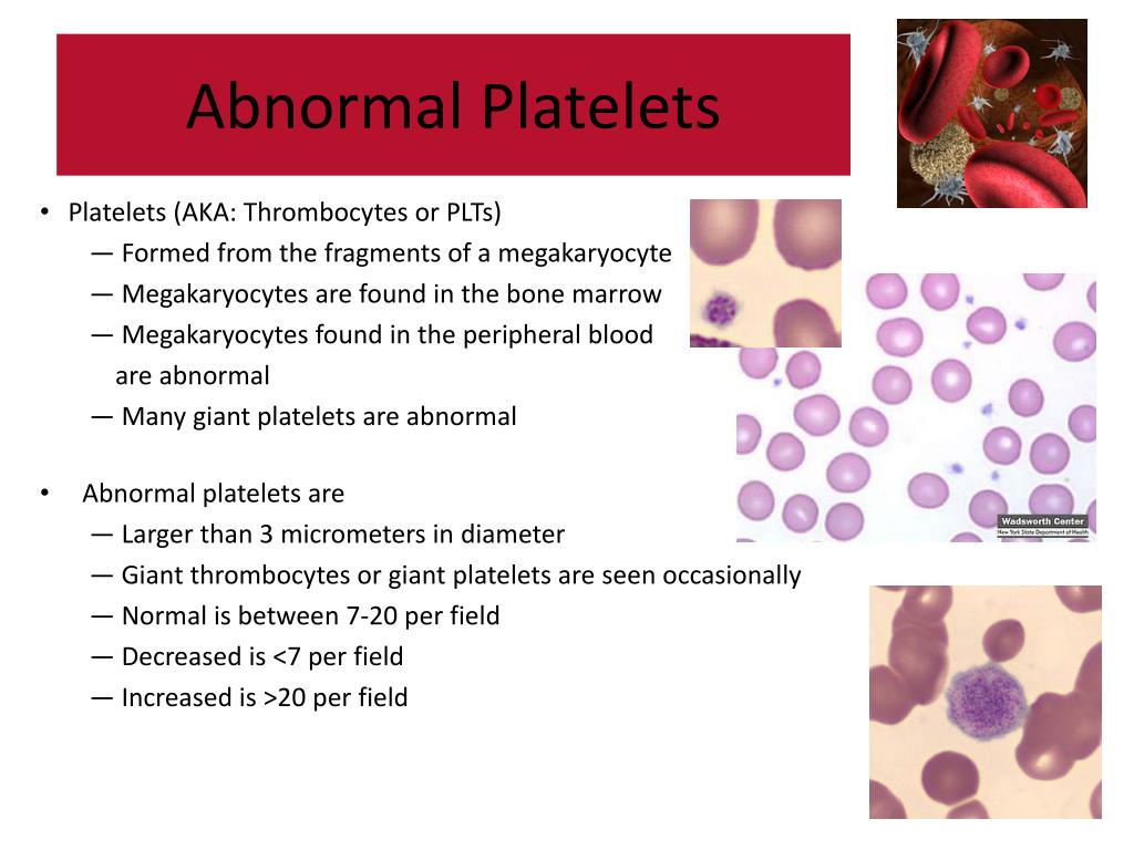 PPT Abnormal Blood Cell Morphology PowerPoint Presentation, free download ID1390932
