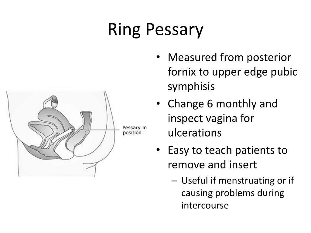 PPT Female Pelvic Organ Prolapse PowerPoint Presentation, free
