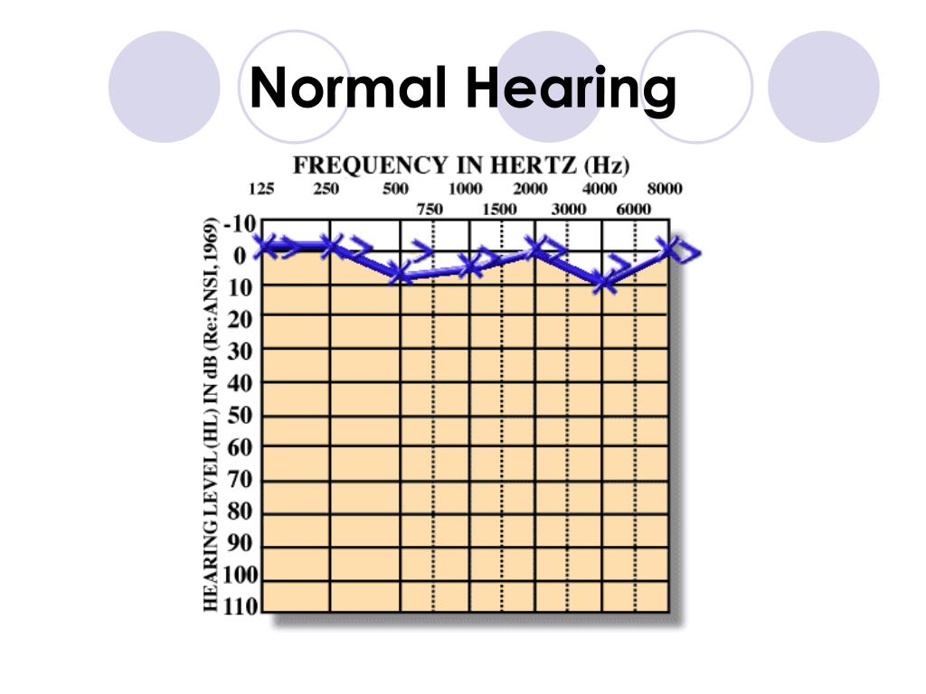 PPT Reading an Audiogram PowerPoint Presentation, free download ID