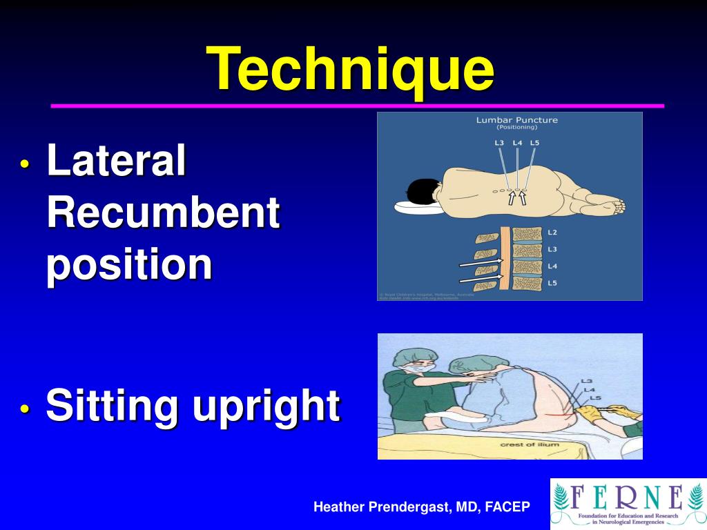 PPT Lumbar Puncture Indications and Procedure PowerPoint