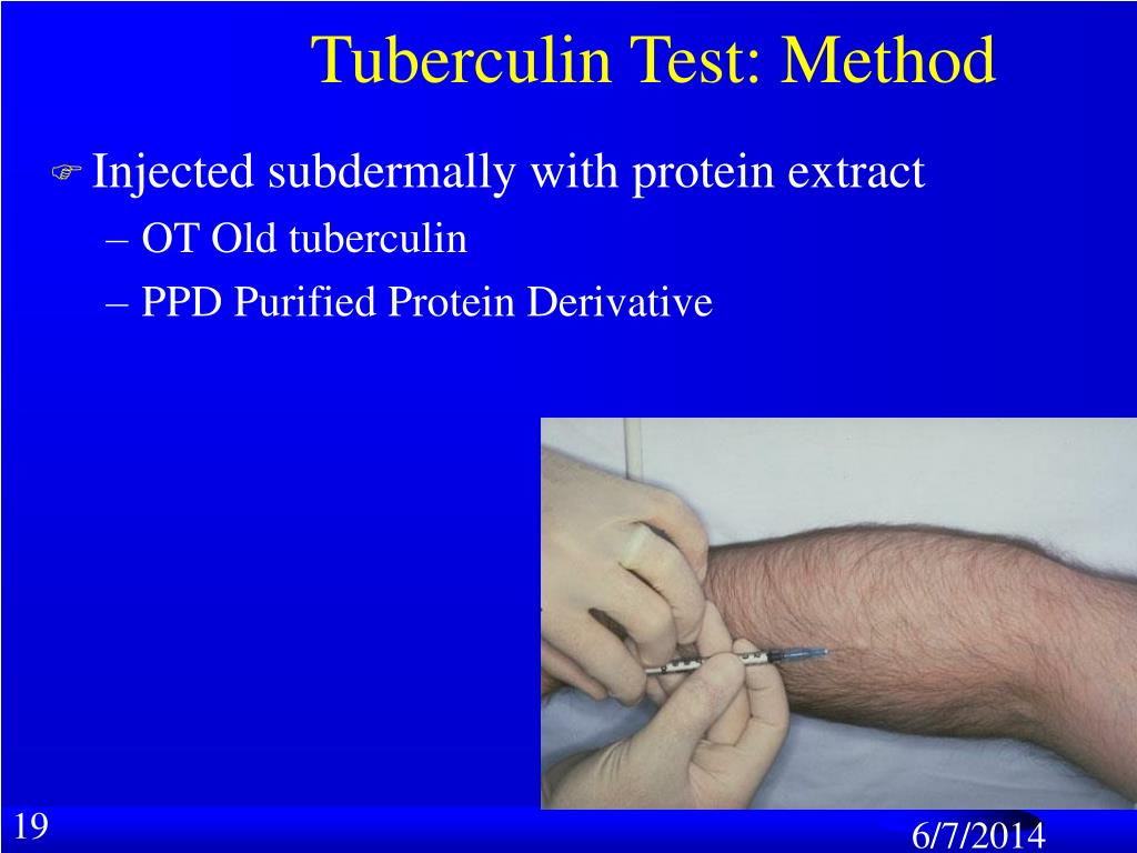 PPT Mycobacterium PowerPoint Presentation, free download ID1411627