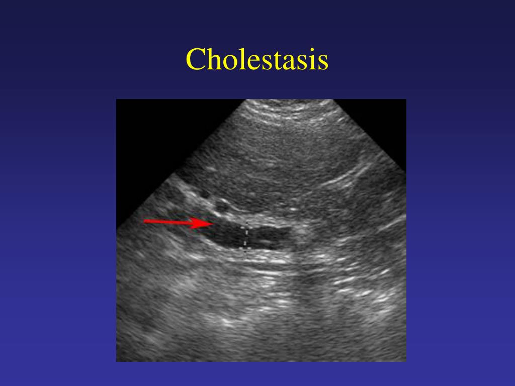 PPT Work up of the Asymptomatic Patient with Liver Enzyme