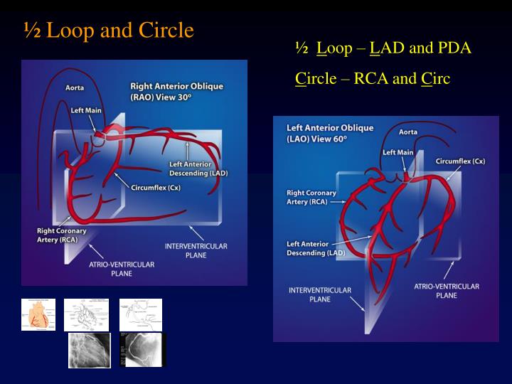 PPT Coronary Anatomy PowerPoint Presentation ID1425998