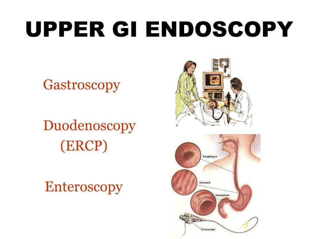 PPT ENDOSCOPY C O N T E N T S PowerPoint Presentation, free download