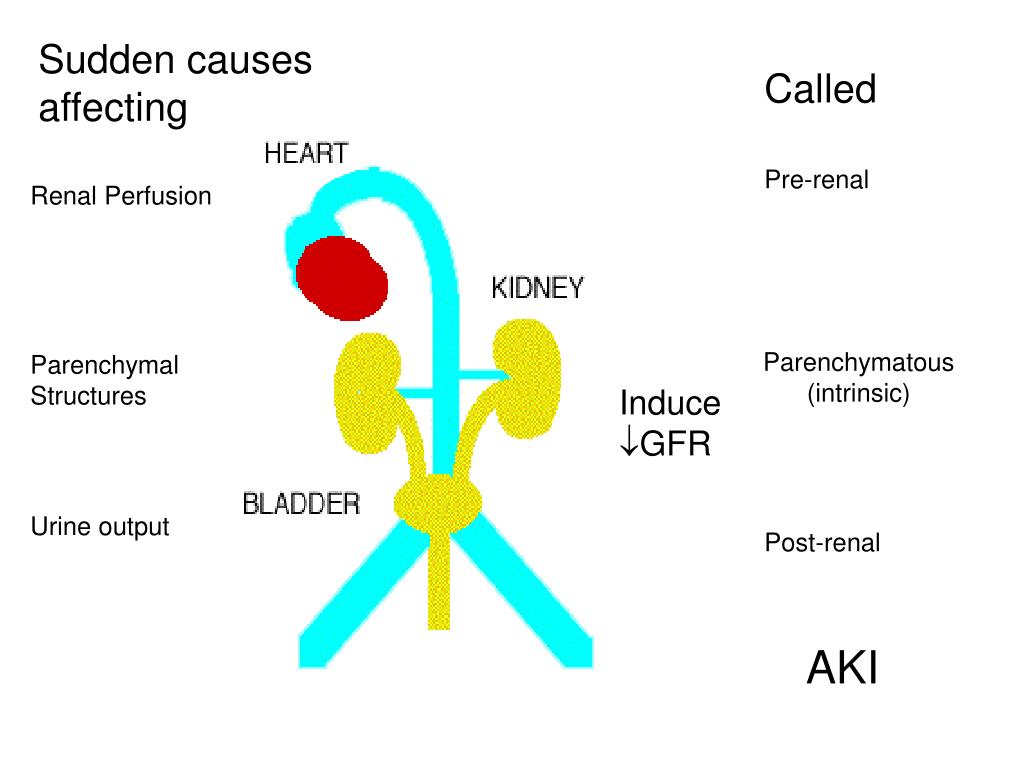PPT Mechanisms and Management in Acute Kidney Injury PowerPoint