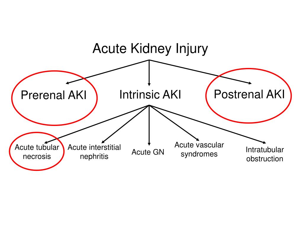 PPT Mechanisms and Management in Acute Kidney Injury PowerPoint