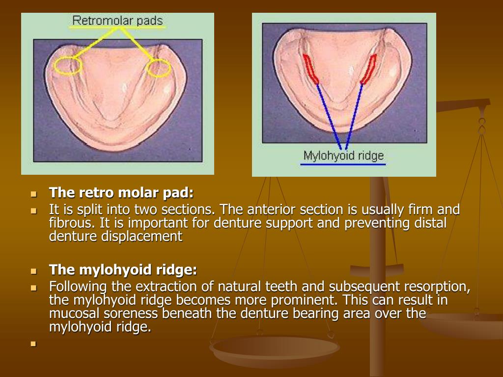 PPT Introduction to Clinical Prosthodontics PowerPoint Presentation
