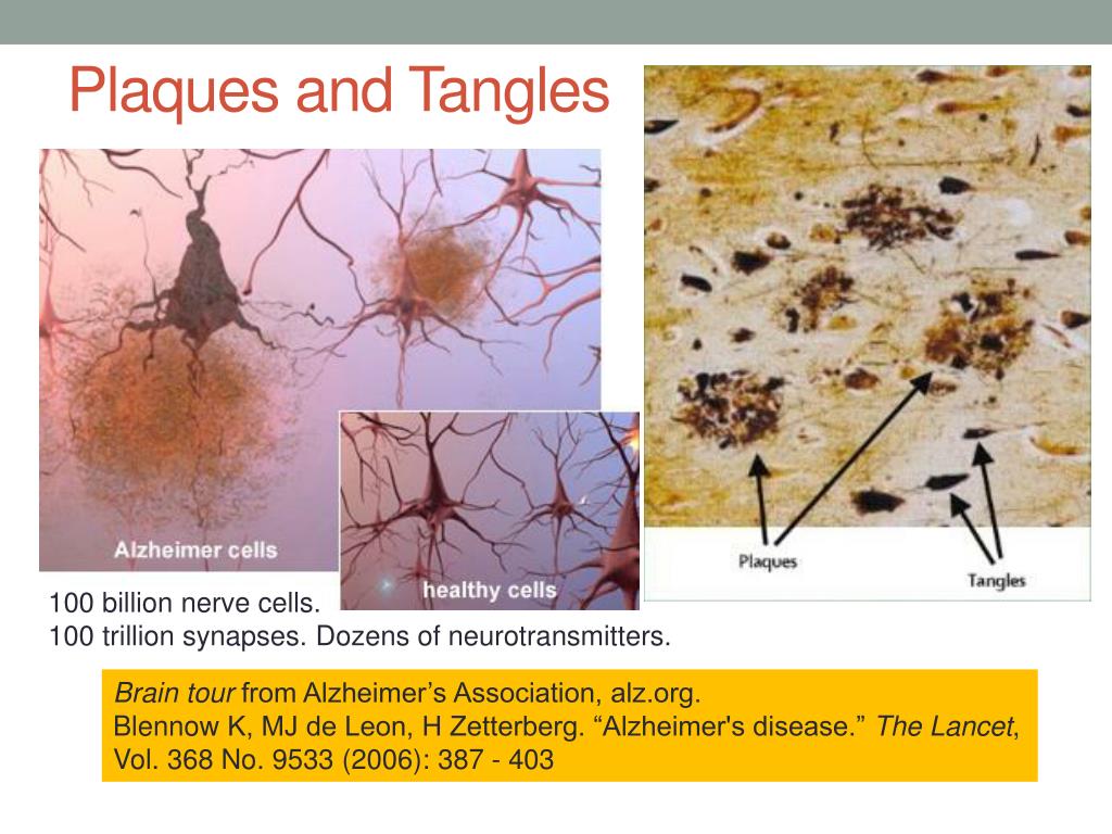 PPT MEDIUM CHAIN TRIGLYCERIDES, Ketone Esters, and ketogenic diets